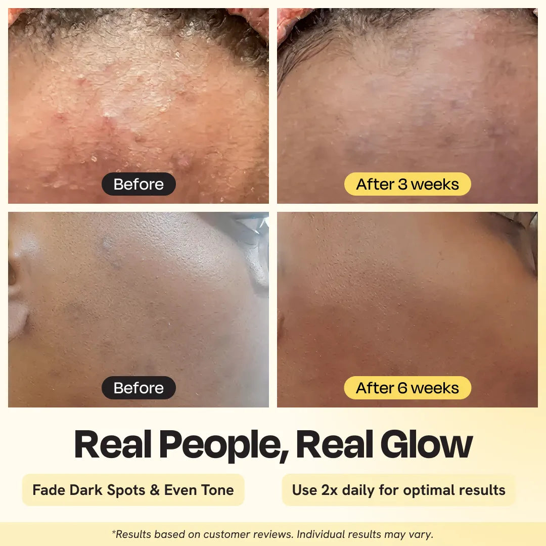 Gleamin  Advanced Brightening Moisturizer