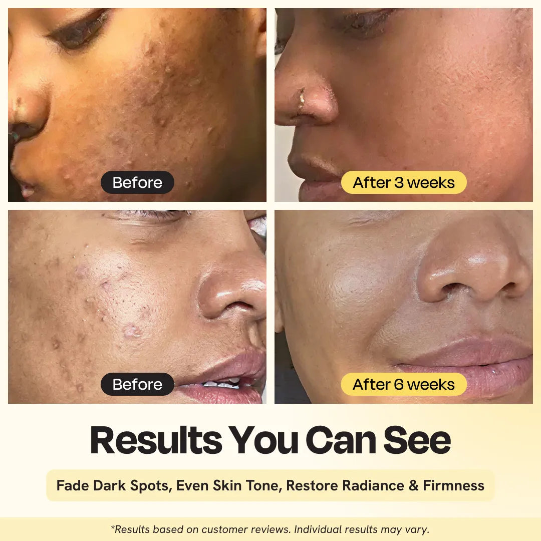 Gleamin Superactive Serum